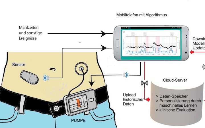 Pankreatit Nedir Belirtileri Nelerdir? Nedenleri ve Tanısı